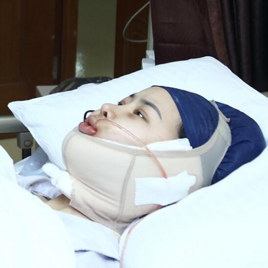 上海時光整形外科醫(yī)院醫(yī)生李靜林做假體隆鼻和反頜手術(shù)怎么樣？