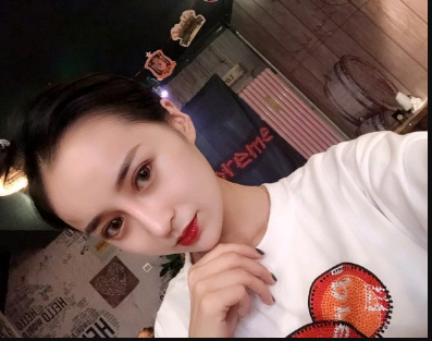 武漢米蘭醫(yī)療美容醫(yī)生柳再億做眼綜合+鼻綜合整形怎么樣？附真實案例對比圖