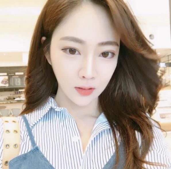 廣州中科美整形醫(yī)院醫(yī)生鄭志敏做鼻部多項(xiàng)綜合整形怎么樣？附案例效果圖