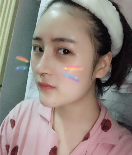 北京伊美爾美容愛康醫(yī)院醫(yī)生柳成做鼻綜合整形怎么樣？附案例效果圖