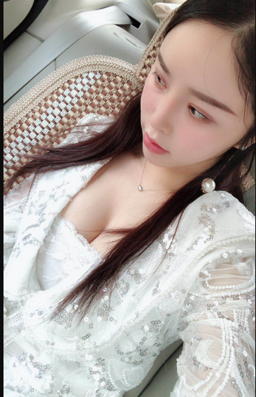 吉林現(xiàn)代整形美容醫(yī)院做假體隆胸效果怎么樣？附醫(yī)院案例效果對(duì)比圖