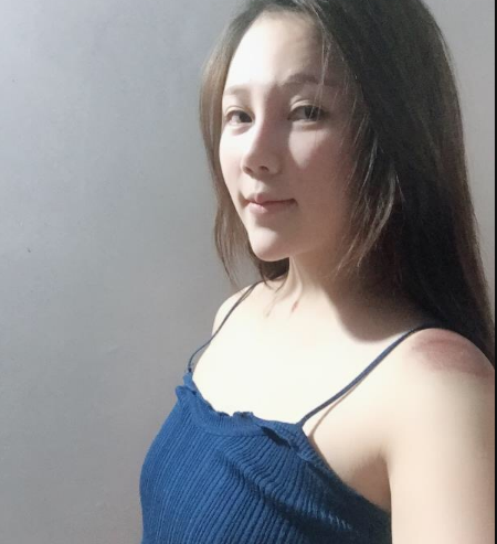 北京東方和諧醫(yī)療整形診所馮斌醫(yī)生做假體隆胸怎么樣？附案例效果對比圖