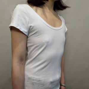 長沙亞韓醫(yī)學美容醫(yī)院醫(yī)生鄭京湘做假體隆胸怎么樣？附醫(yī)生案例效果對比圖