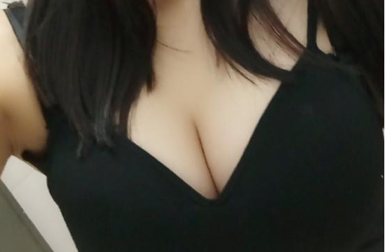 武漢伽美醫(yī)療美容醫(yī)院醫(yī)生朱富初做自體脂肪隆胸怎么樣？看案例