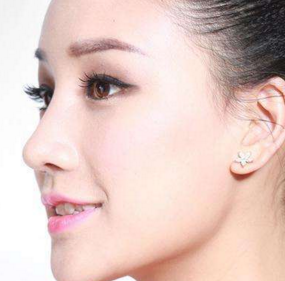 佛山市順德區(qū)北滘醫(yī)硅膠豐額頭