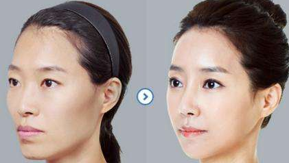 黑龍江省中西醫(yī)結(jié)合研究所附屬醫(yī)院整形美容科面部填充