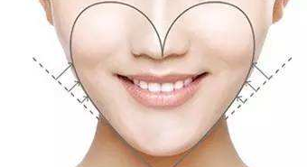 寧波珈禾整形?？漆t(yī)院假體墊下巴