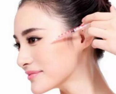 汕頭愛麗諾整形美容醫(yī)院自體脂肪填充太陽穴