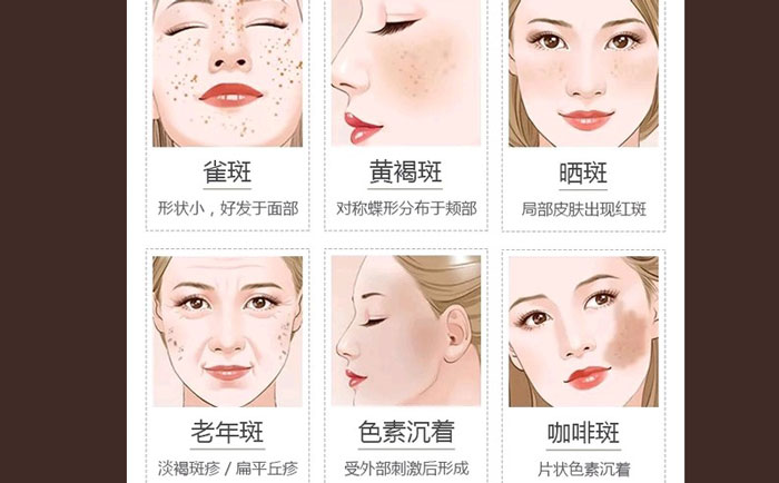 醫(yī)院激光祛斑貴不貴？正規(guī)醫(yī)院激光祛斑多少錢？