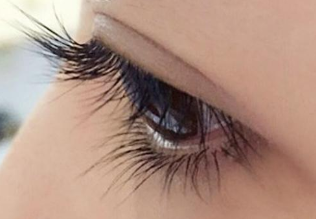 重慶當代整形美容醫(yī)院雙眼皮