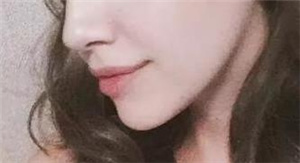 深圳陽光整形美容醫(yī)院隆鼻修復(fù)