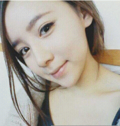 上海時(shí)光整形醫(yī)生何晉龍做假體隆鼻效果怎么樣？附案例效果對(duì)比圖