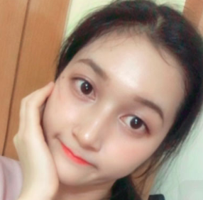 上海時(shí)光整形醫(yī)院做面部玻尿酸注射效果怎么樣？