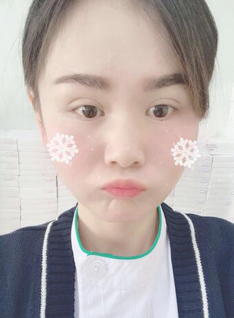 上海時(shí)光整形醫(yī)生何晉龍做下頜角磨骨術(shù)前術(shù)后案例效果對(duì)比圖