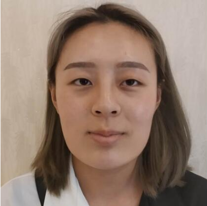 上海時(shí)光整形醫(yī)院做雙眼皮怎么樣？附石重明醫(yī)生雙眼皮+隆鼻+下頜角磨骨案例效果對比圖