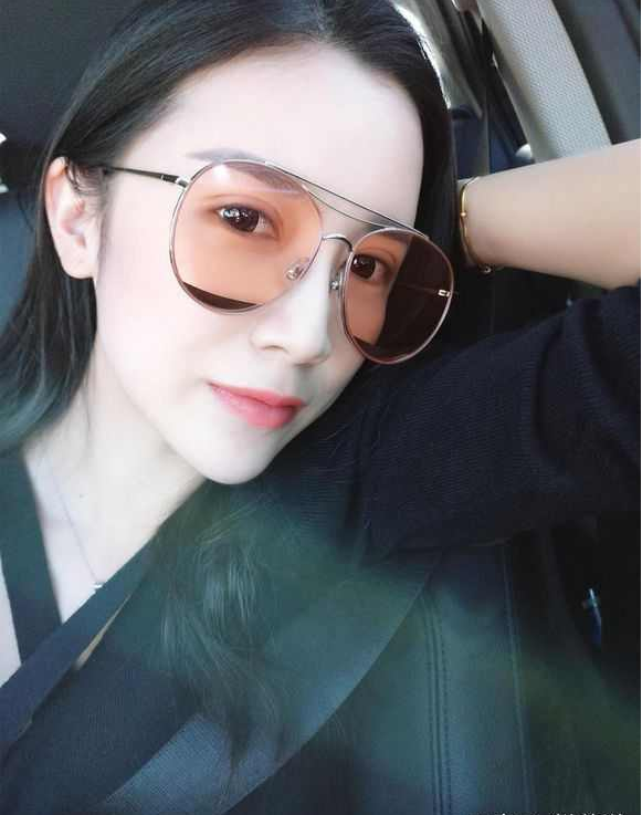 上海時(shí)光整形醫(yī)院張晶醫(yī)生做開眼角怎么樣？附真實(shí)效果圖