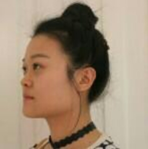 上海時(shí)光整形醫(yī)院左雯君醫(yī)生注射瘦臉針效果怎么樣？附真實(shí)案例圖