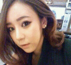 上海時光整形醫(yī)生何晉龍做假體隆鼻效果怎么樣？附案例效果對比圖