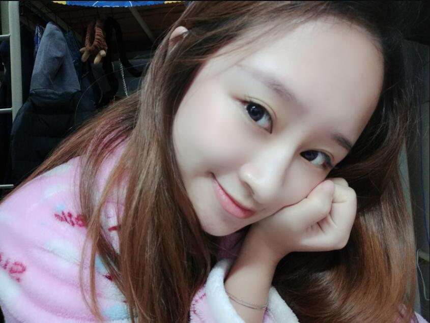 上海時光整形做玻尿酸注射隆鼻效果怎么樣？附陳文慧醫(yī)生真實案例對比圖