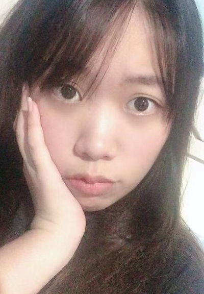 合肥韓美整形美容醫(yī)院做去眼袋效果怎么樣?附金壽信醫(yī)生去眼袋案例效果圖 合肥韓美整形美容醫(yī)院做去眼袋效果怎么樣?附金壽信醫(yī)生去眼袋案例效果圖