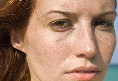 天津維美醫(yī)療美容醫(yī)院激光祛斑