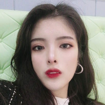 合肥韓美整形醫(yī)院做雙眼皮+開眼角效果怎么樣?附石顯武醫(yī)生真實案例效果圖