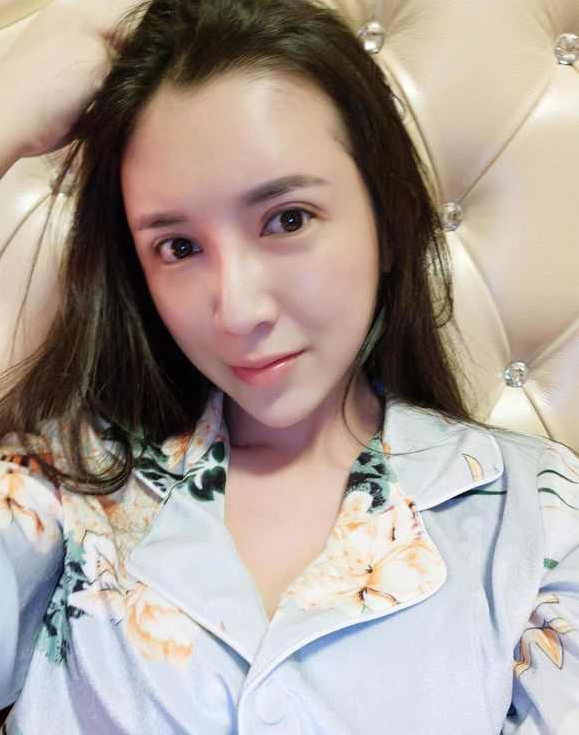 上海時(shí)光整形醫(yī)院張晶醫(yī)生做開眼角怎么樣？附真實(shí)效果圖