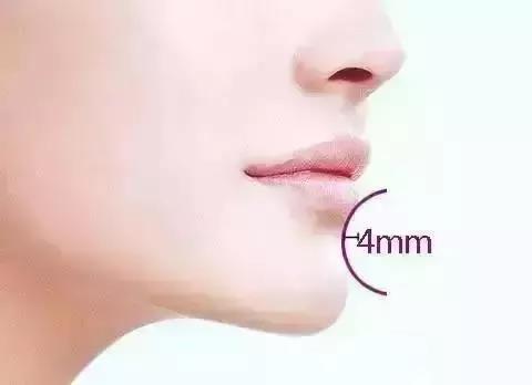 東莞華美醫(yī)療美容醫(yī)院假體隆下巴