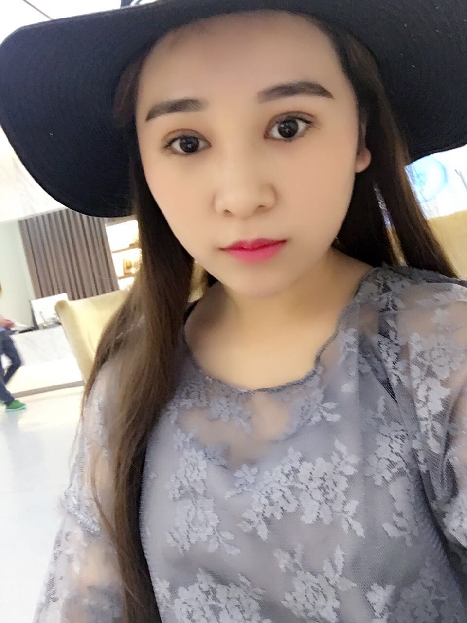 蚌埠韓美美萊整形醫(yī)生鄭捷做開眼角怎么樣？附案例效果圖