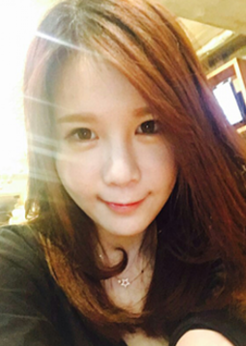 安康希顏醫(yī)療整形醫(yī)生王奇效做面部吸脂案例效果對比圖