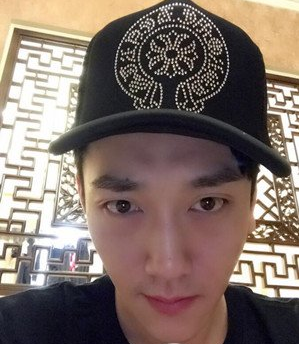 鞍山燕麗醫(yī)療美容醫(yī)院薛媚醫(yī)生做去眼袋效果怎么樣？附案例效果對比圖