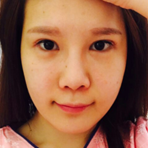 安康希顏醫(yī)療整形醫(yī)生王奇效做面部吸脂案例效果對比圖