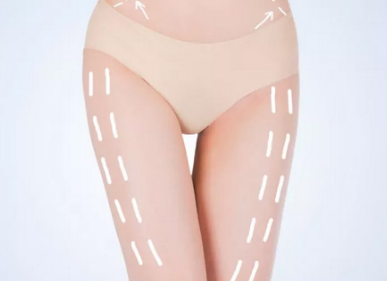 沈陽(yáng)杏林整形美容醫(yī)院大腿吸脂