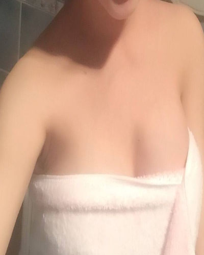 安慶市立醫(yī)院整形外科華棟醫(yī)生做自體脂肪隆胸效果怎么樣？附真實(shí)案例圖