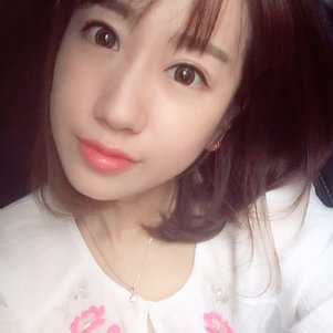 蚌埠韓美美萊整形做玻尿酸面部除皺效果怎么樣？附陳澤醫(yī)生案例效果圖