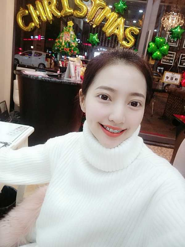 巴中華醫(yī)口腔醫(yī)院做牙齒矯正效果好嗎？附母汶靈醫(yī)生牙齒矯正案例效果圖