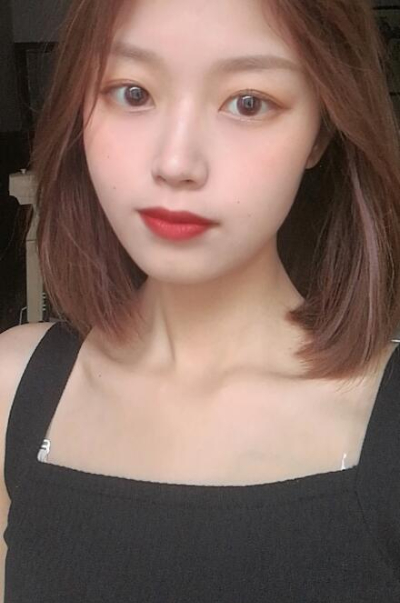 安陽市人民醫(yī)院燒傷整形中心做手術激光祛斑效果怎么樣？附案例效果對比圖