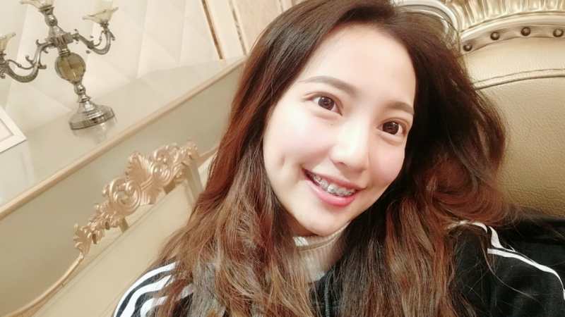 巴中華醫(yī)口腔醫(yī)院做牙齒矯正效果好嗎？附母汶靈醫(yī)生牙齒矯正案例效果圖