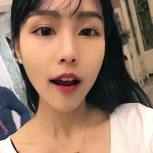 鞍山時代口腔門診部洗牙效果怎么樣？附申元休醫(yī)生洗牙案例效果圖