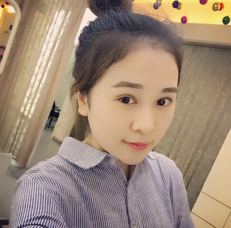 蚌埠韓美美萊整形醫(yī)生鄭捷做開眼角怎么樣？附案例效果圖