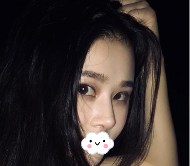 蚌埠韓美美萊整形醫(yī)生歷芳做耳軟骨隆鼻怎么樣？附耳軟骨隆鼻案例對比圖