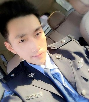 鞍山燕麗醫(yī)療美容醫(yī)院薛媚醫(yī)生做去眼袋效果怎么樣？附案例效果對比圖