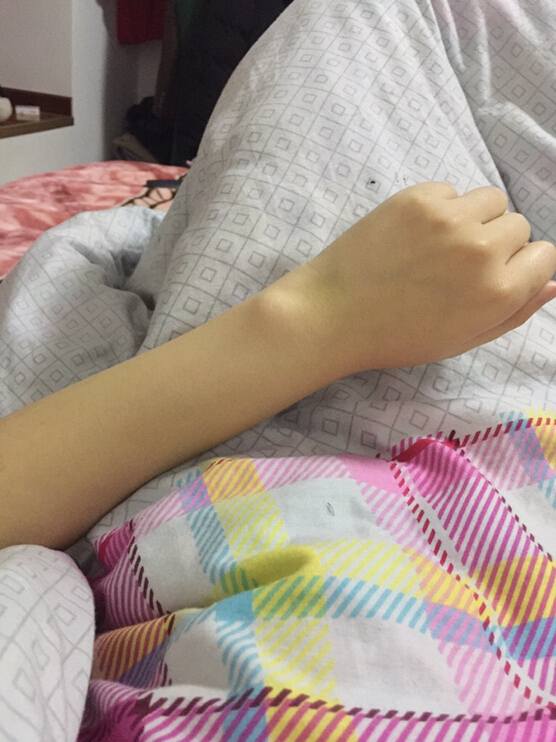 蚌埠市第三人民醫(yī)院燒傷整形科李方奇注射美白針效果怎么樣？安全嗎？附案例