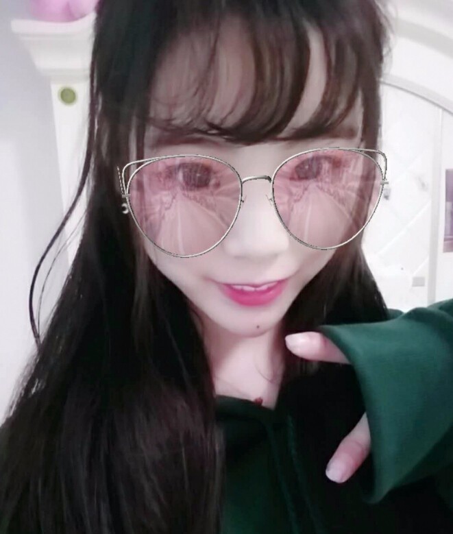 保定市第五醫(yī)院美容整形科做玻尿酸墊下巴怎么樣？附楊瑞萍醫(yī)生案例效果圖