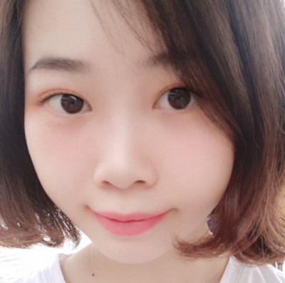 保定安卓貝拉醫(yī)療美容門(mén)診部孫大山醫(yī)生做雙眼皮+去眼袋怎么樣？附案例效果對(duì)比圖