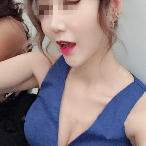 保定杏林中醫(yī)醫(yī)院整形外科醫(yī)生從相文做自體脂肪隆胸效果怎么樣？附隆胸案例