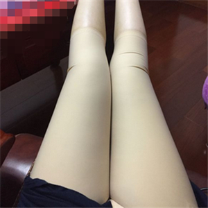 保定市第五醫(yī)院美容整形科做大腿吸脂怎么樣？附劉根立醫(yī)生案例效果圖