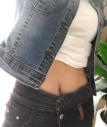 保定現(xiàn)代女子醫(yī)院整形美容中心做腰腹部吸脂怎么樣？附林秀蓮醫(yī)生案例效果圖