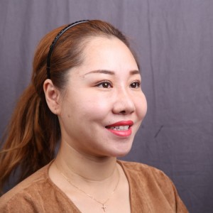 保定東陽口腔醫(yī)院趙晨醫(yī)生做瓷貼面怎么樣?附瓷貼面案例效果對比圖 保定東陽口腔醫(yī)院趙晨醫(yī)生做瓷貼面怎么樣?附瓷貼面案例效果對比圖