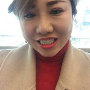 保定東陽口腔醫(yī)院趙晨醫(yī)生做瓷貼面怎么樣?附瓷貼面案例效果對比圖 保定東陽口腔醫(yī)院趙晨醫(yī)生做瓷貼面怎么樣?附瓷貼面案例效果對比圖